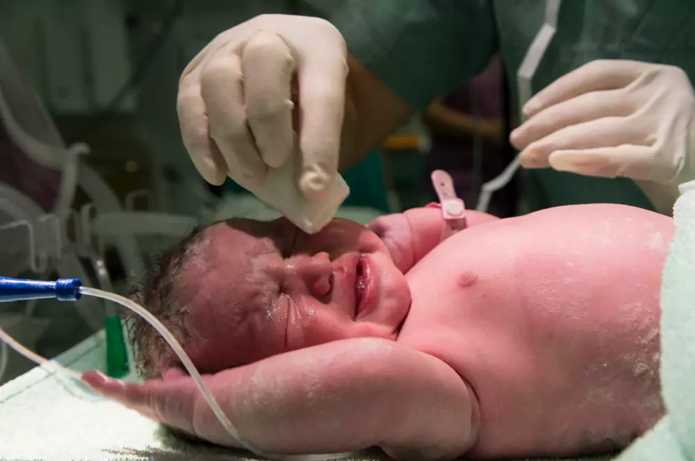 Normal delivery & Cesarean section